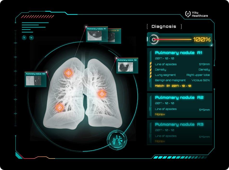 care.aiTM胸部CT智能四維影像系統(tǒng)                                    